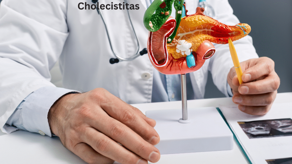Cholecistitas Insights: Comprehensive Information on Diagnosis, Treatment, and Lifestyle.