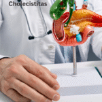 Cholecistitas
