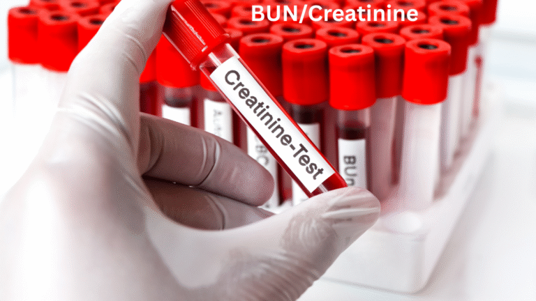 BUN/Creatinine