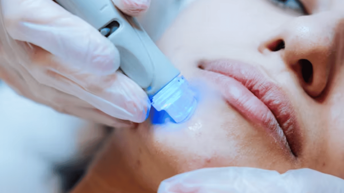 Lip Flip Before and After